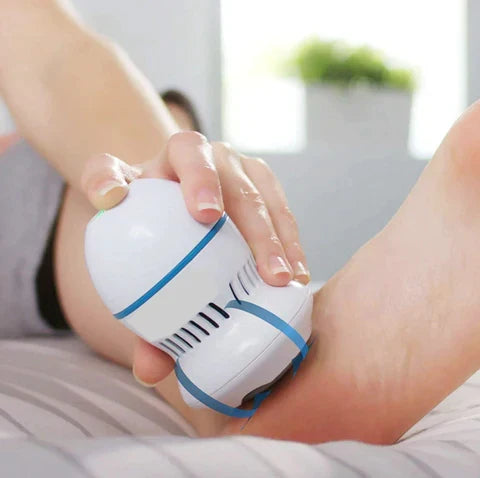 Vividra Vacuum Callus Remover
